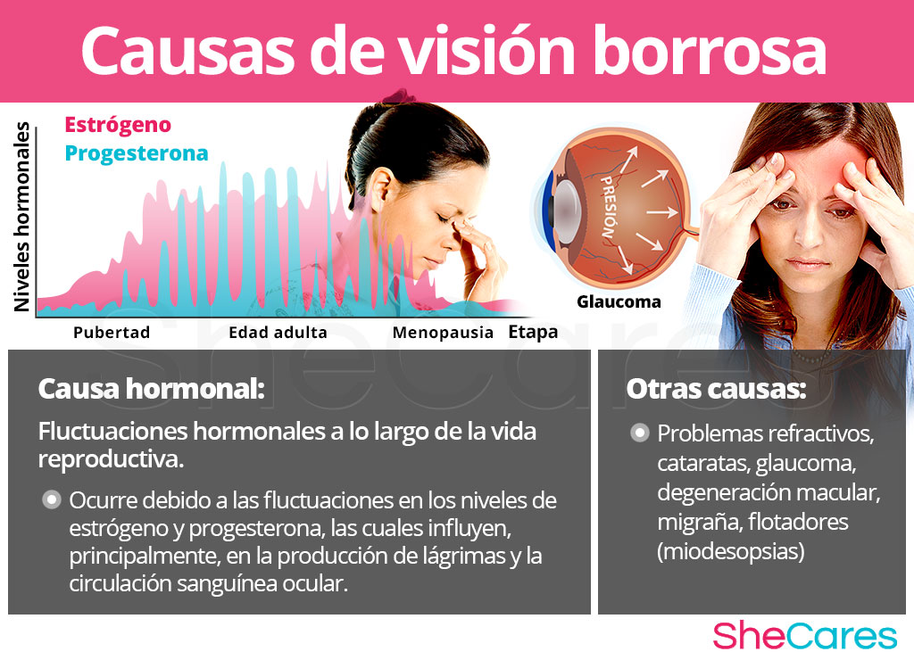 Visión borrosa - Causas