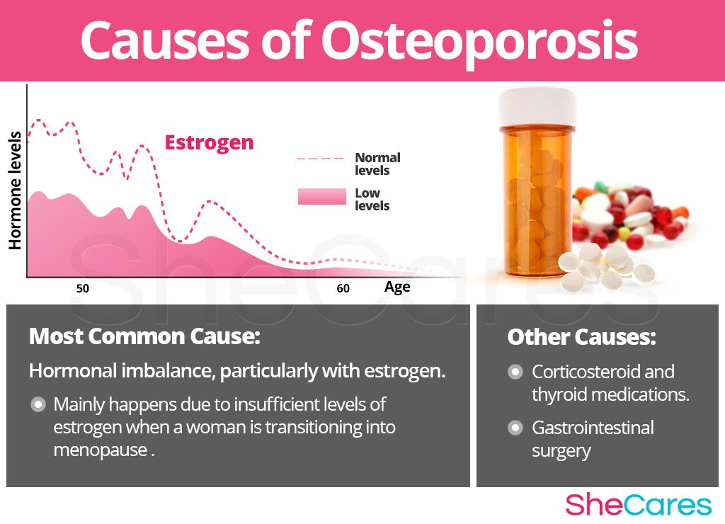 Causes of Osteoporosis