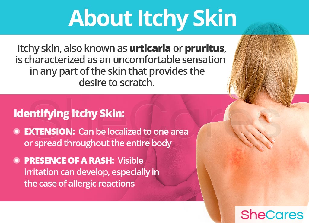 About Itchy Skin