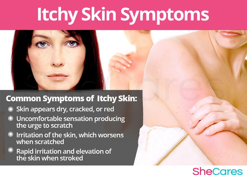 Itchy Skin  -  Signs and Symptoms
