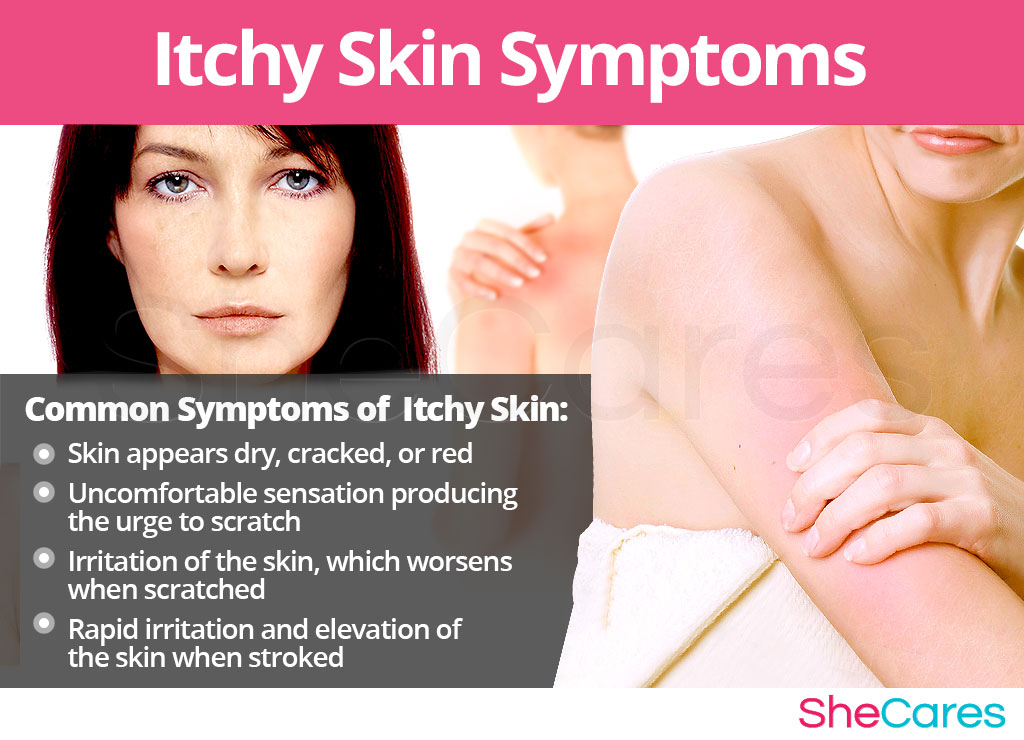 Itchy Skin - Signs and Symptoms