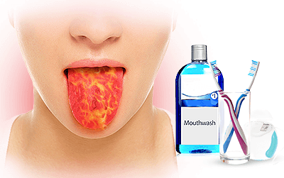 Effective Home Remedies for Burning Mouth Syndrome