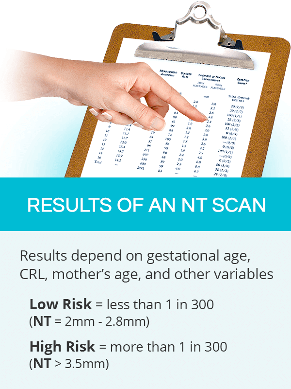 Nuchal translucency results