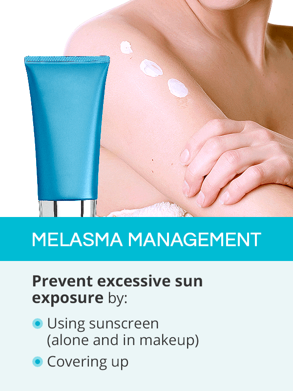 Melasma Management