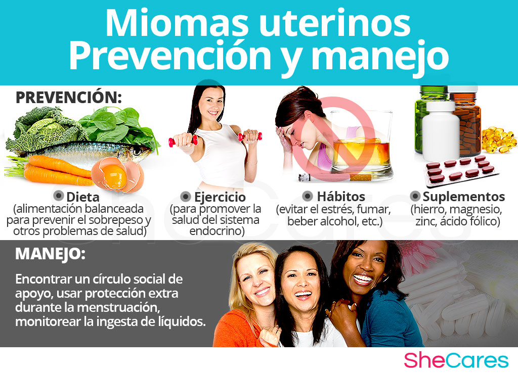 Miomas uterinos - Prevención y manejo