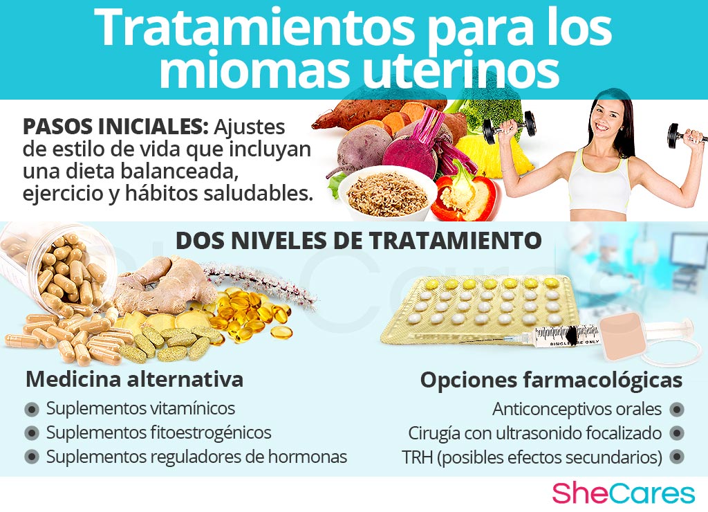 Tratamientos para los miomas uterinos