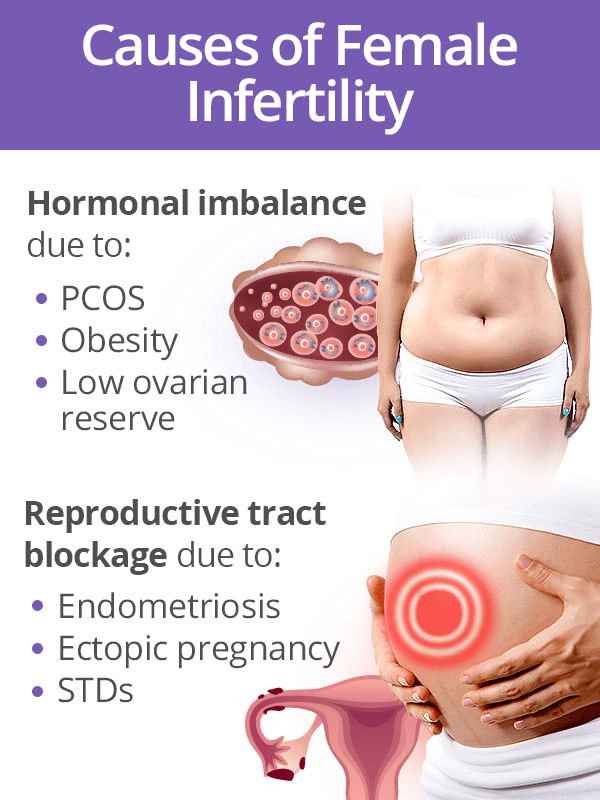 Causes of female infertility