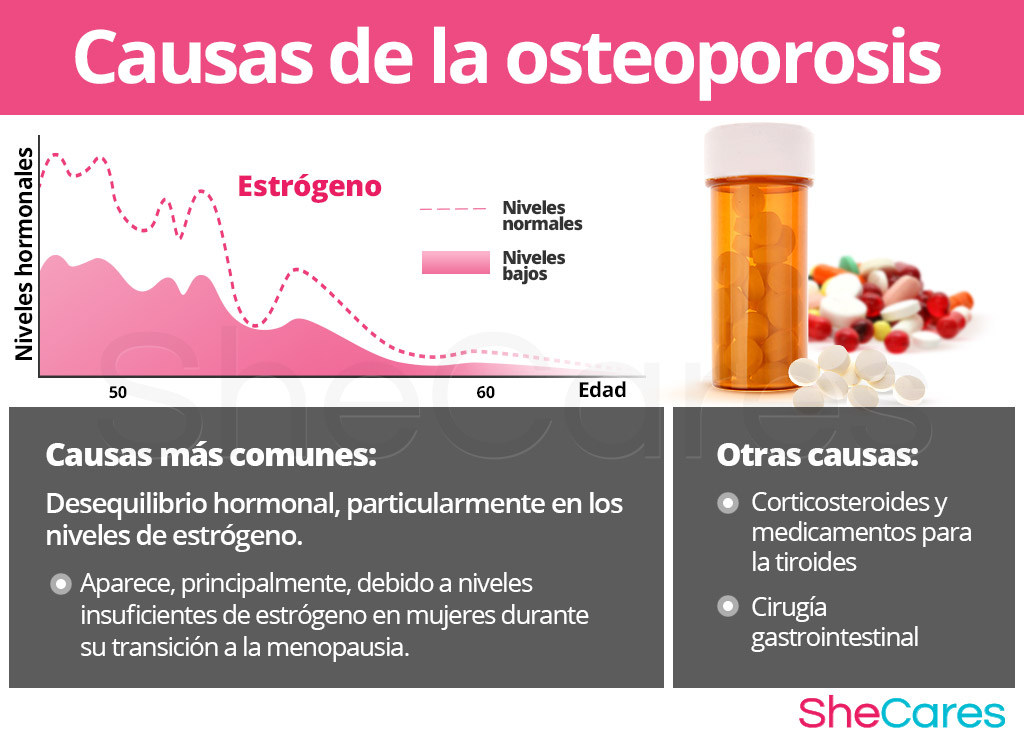 Causas de osteoporosis