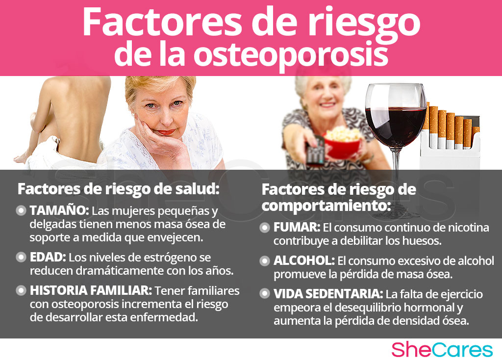 Factores de riesgo de la osteoporosis