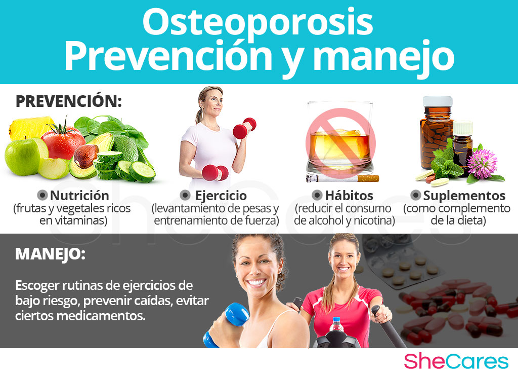 Prevención y manejo de la osteoporosis