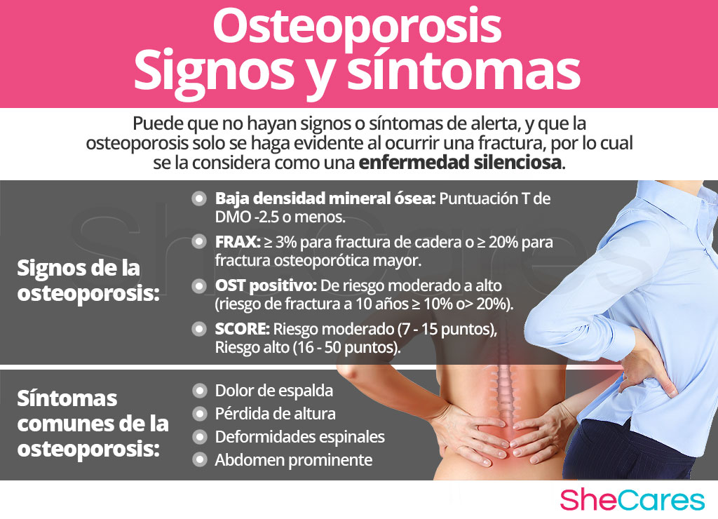 Signos y síntomas de la osteoporosis