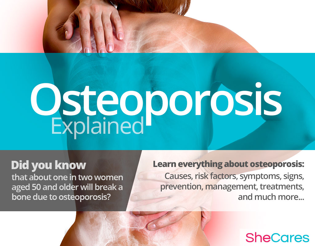 Osteoporosis: Symptoms, Causes and Treatment