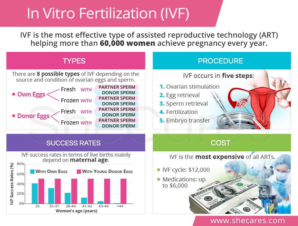 In Vitro Fertilization (IVF)