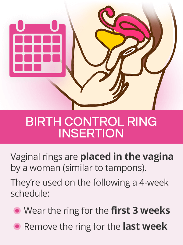 Birth control ring insertion