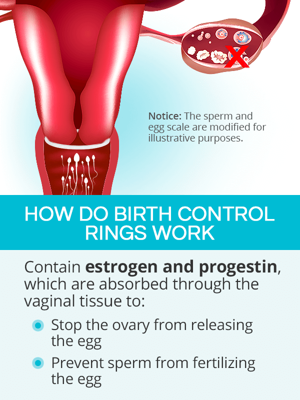 How do birth control rings work