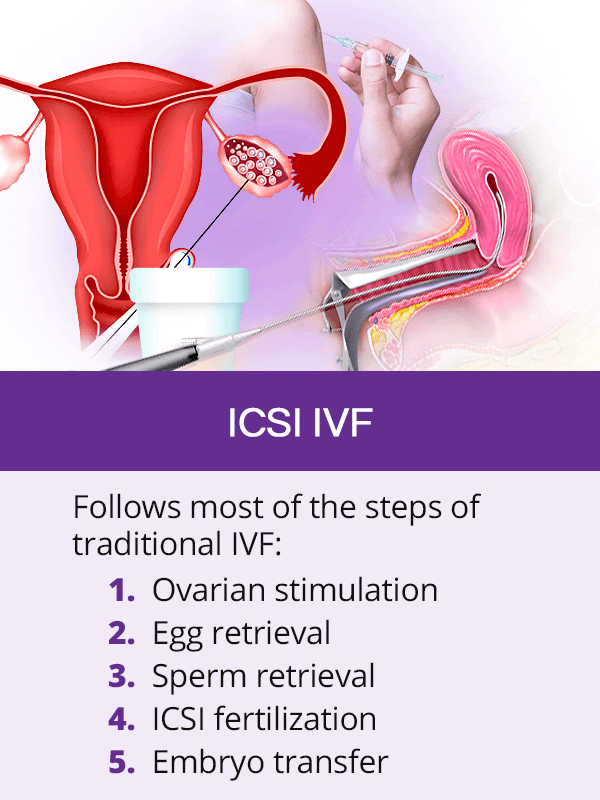 ICSI IVF