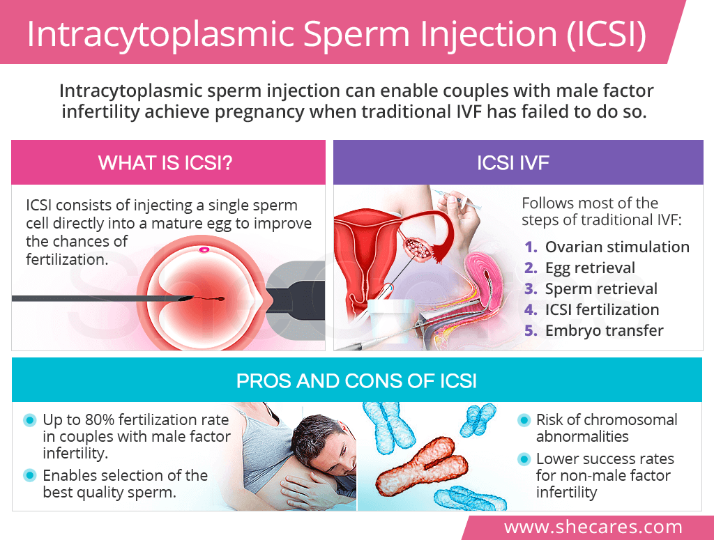 Intracystoplamic sperm injection (ICSI)