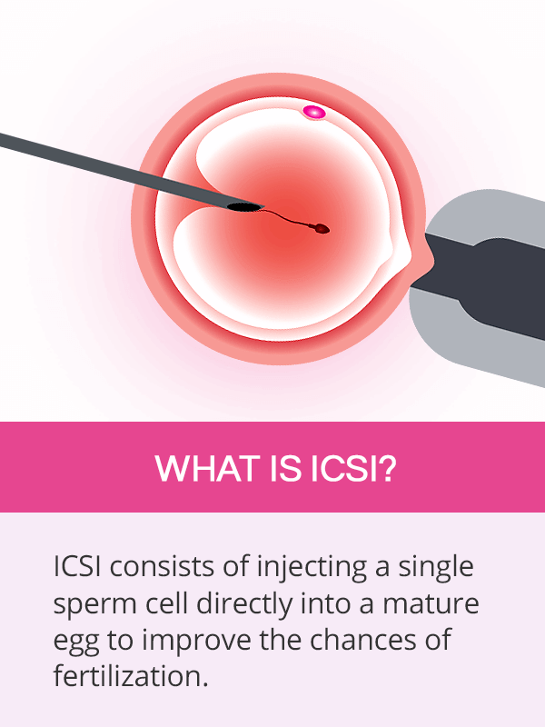 What is ICSI
