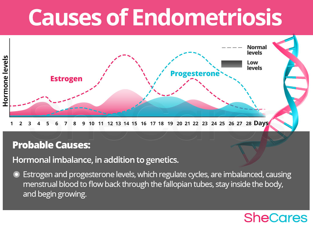 Causes of Endometriosis