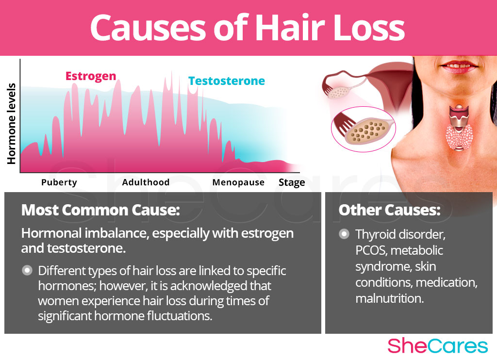 Hair Loss - Hormonal Imbalance Symptoms | SheCares