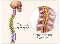 hrt vertebrae