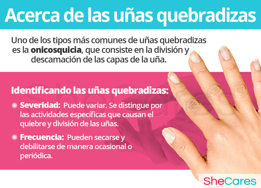 Acerca las uñas quebradizas