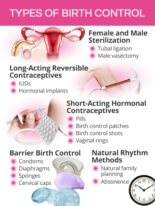 Types of birth control