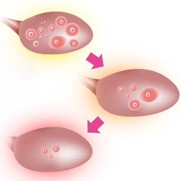 Fertility and age