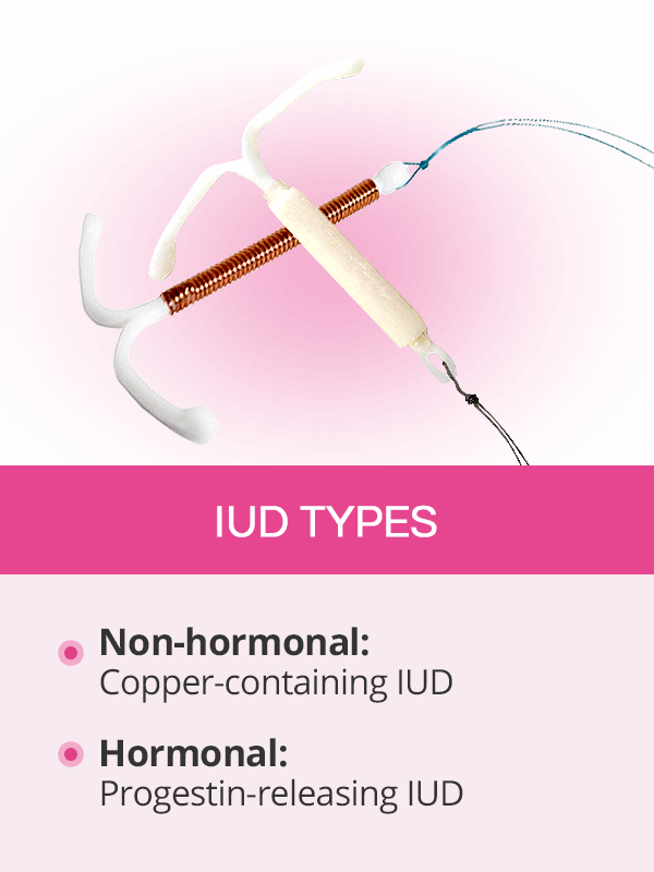 IUD types