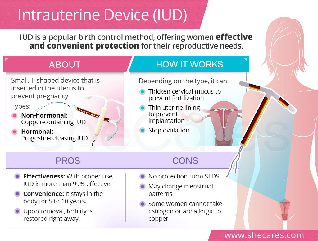 IUD