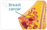 HRT Study