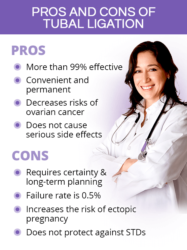 Pros and cons of tubal ligation