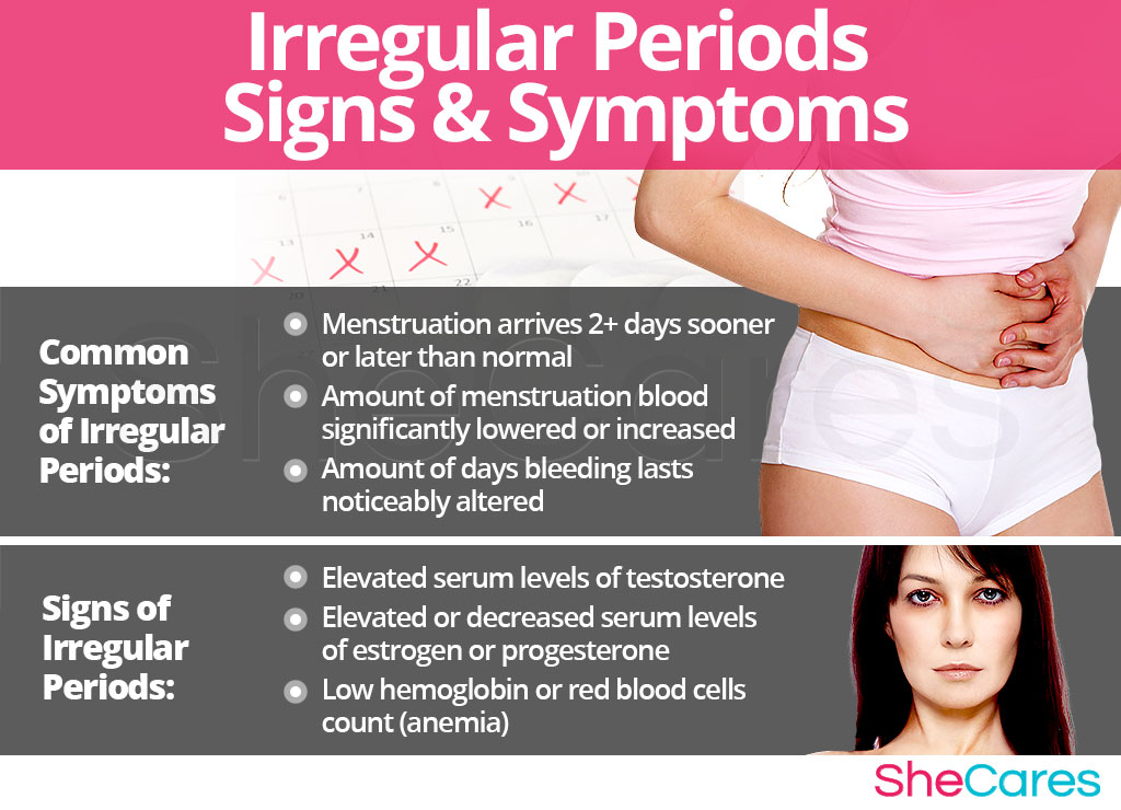 Irregular Periods - Signs and Symptoms