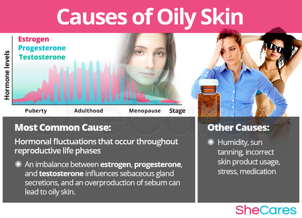 Causes of Oily Skin