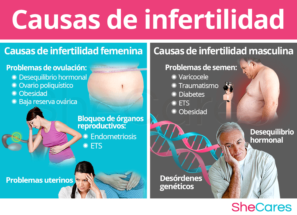 Causas de infertilidad