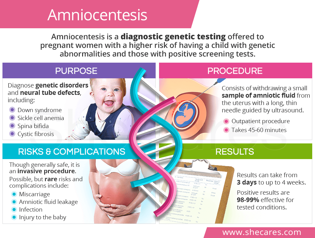 pre ipo investing risks of amniocentesis