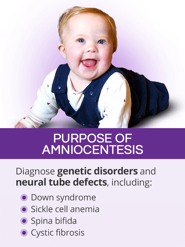 Purpose of amniocentesis