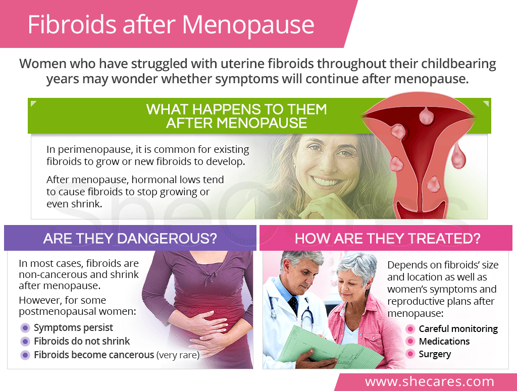 Uterine Fibroids after Menopause