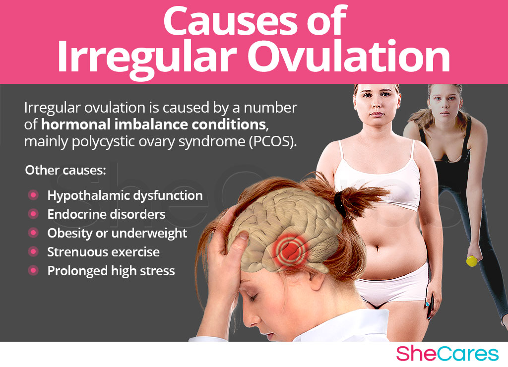 Causes of irregular ovulation