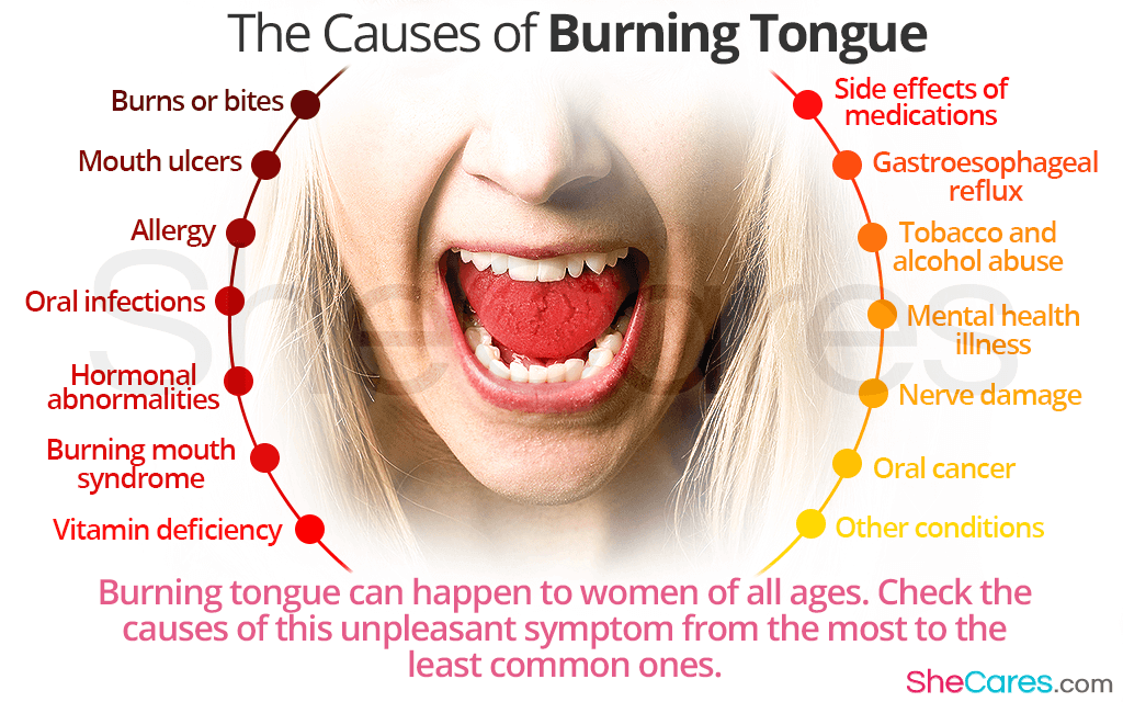 Causes of Burning Tongue: Most Common to Less Common