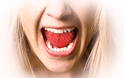 Causes of Burning Tongue: Most Common to Less Common