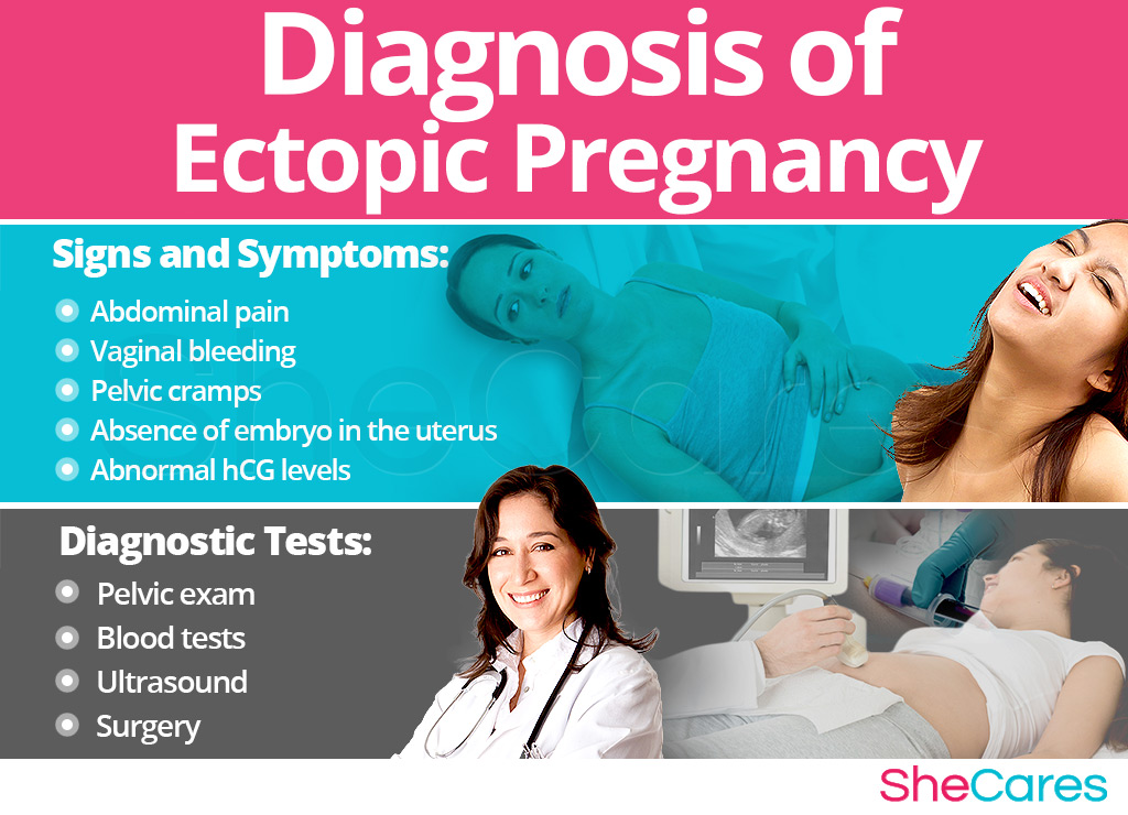 Diagnosis of Ectopic Pregnancy