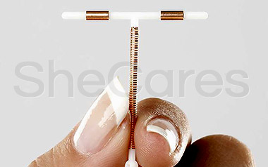 The Progesterone IUD