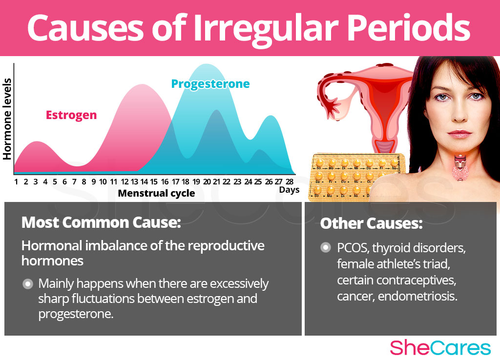 Causes of Irregular Periods