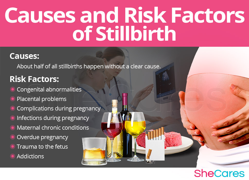 Causes and Risk Factors of Stillbirth