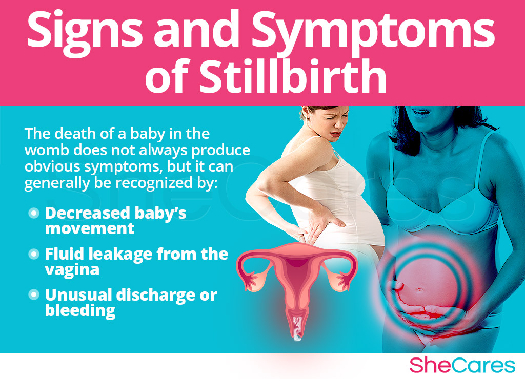 Signs and Symptoms of Stillbirth