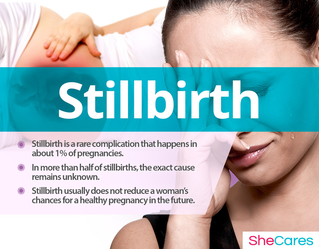 Stillbirth