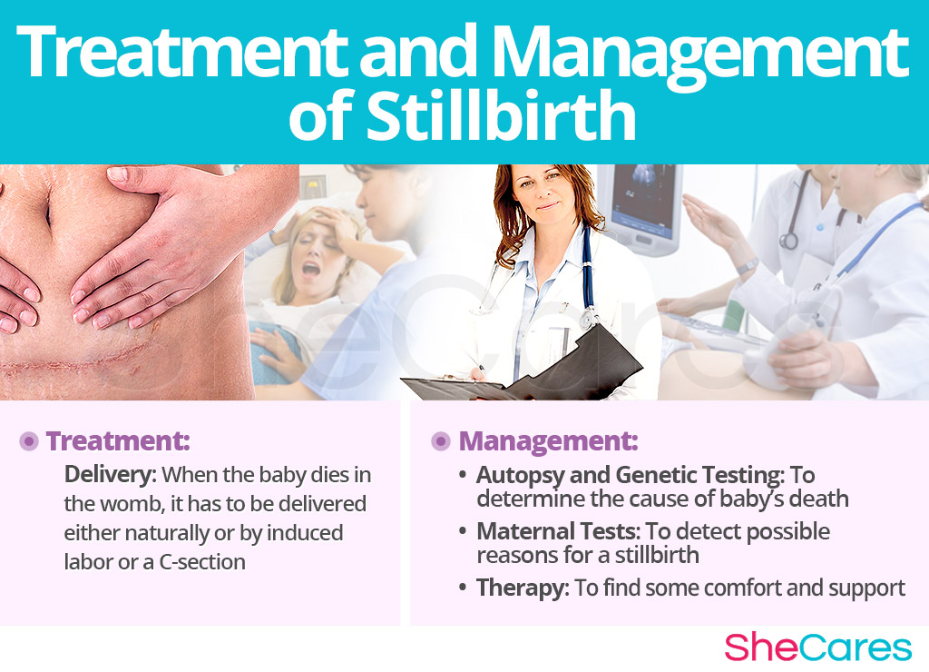 Treatment and Management of Stillbirth