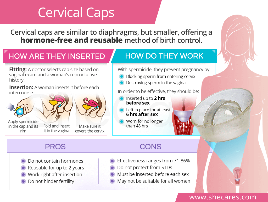 Cervical caps