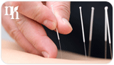 Alternative treatments like acupuncture are good for menopausal women.